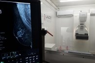 Por un mes, IOSPER brindará mamografías gratuitas a sus afiliadas